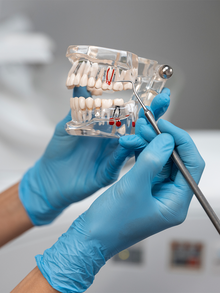 Dental model demonstrating long-term implant survival at Sukriti Hospital in Bharuch. Dr. Vihang Sukhadia's expertise in durable dental implants.