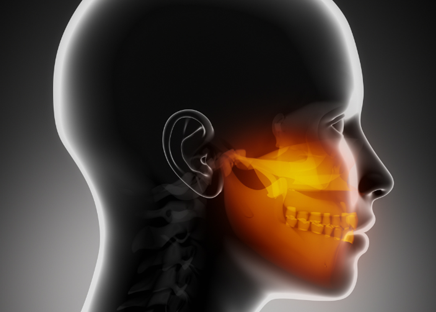 X-ray showing TMJ Disorder in a patient treated at Sukriti Hospital in Bharuch. Advanced arthroscopic jaw joint surgery by Dr. Vihang Sukhadia for TMJ issues.